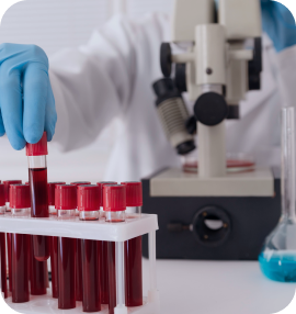 Коагулограма