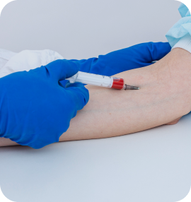 Реакція Вассермана на сифіліс (RW)